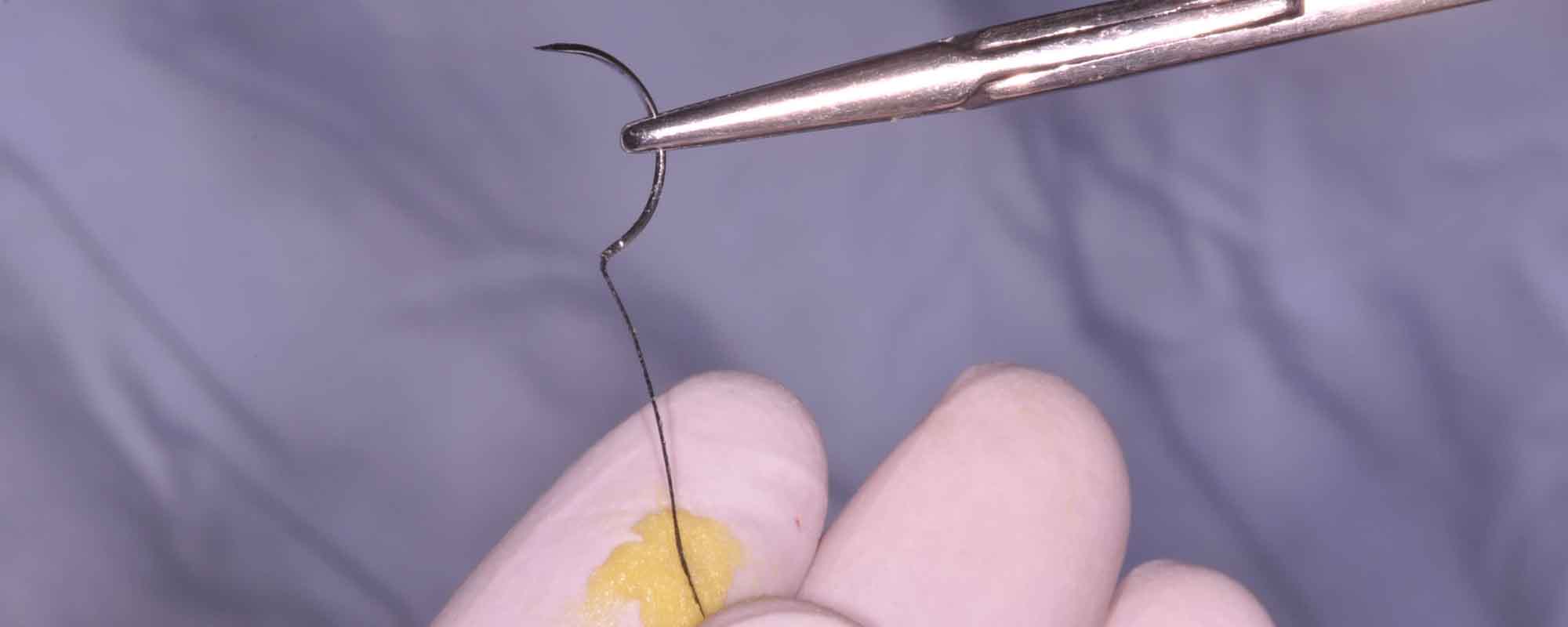 Proheal nos fios de sutura