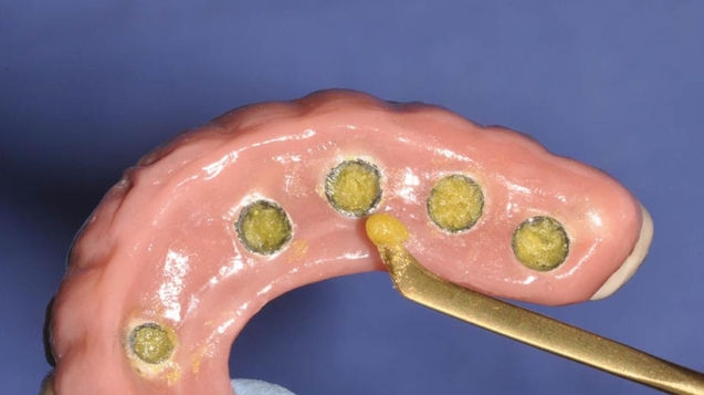 Proheal no protocolo